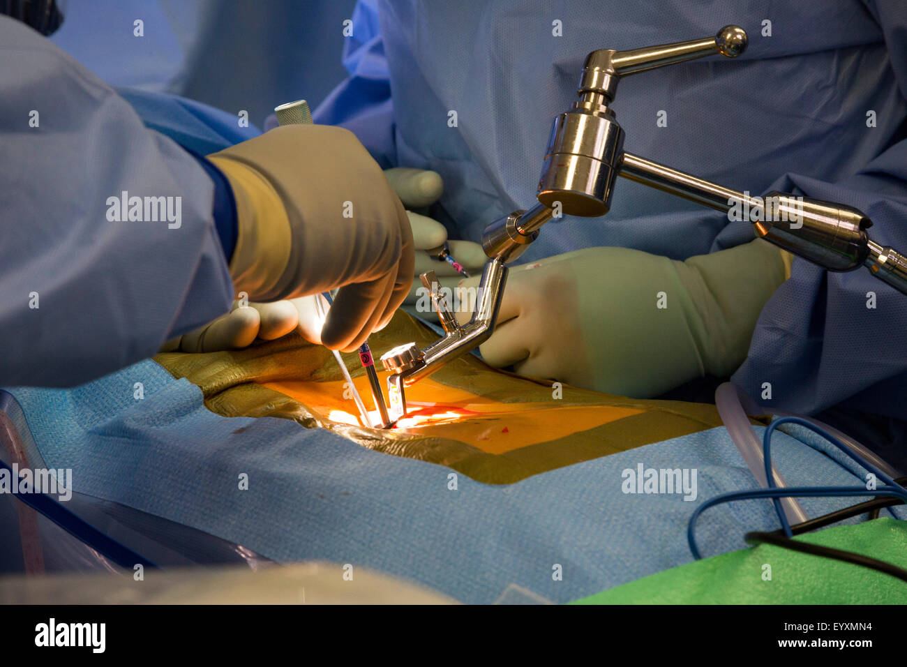 Englewood, Colorado - Dr. Paul Elliott performs minimally invasive lumbar spine surgery on a patient at Swedish Medical Center. Stock Photo