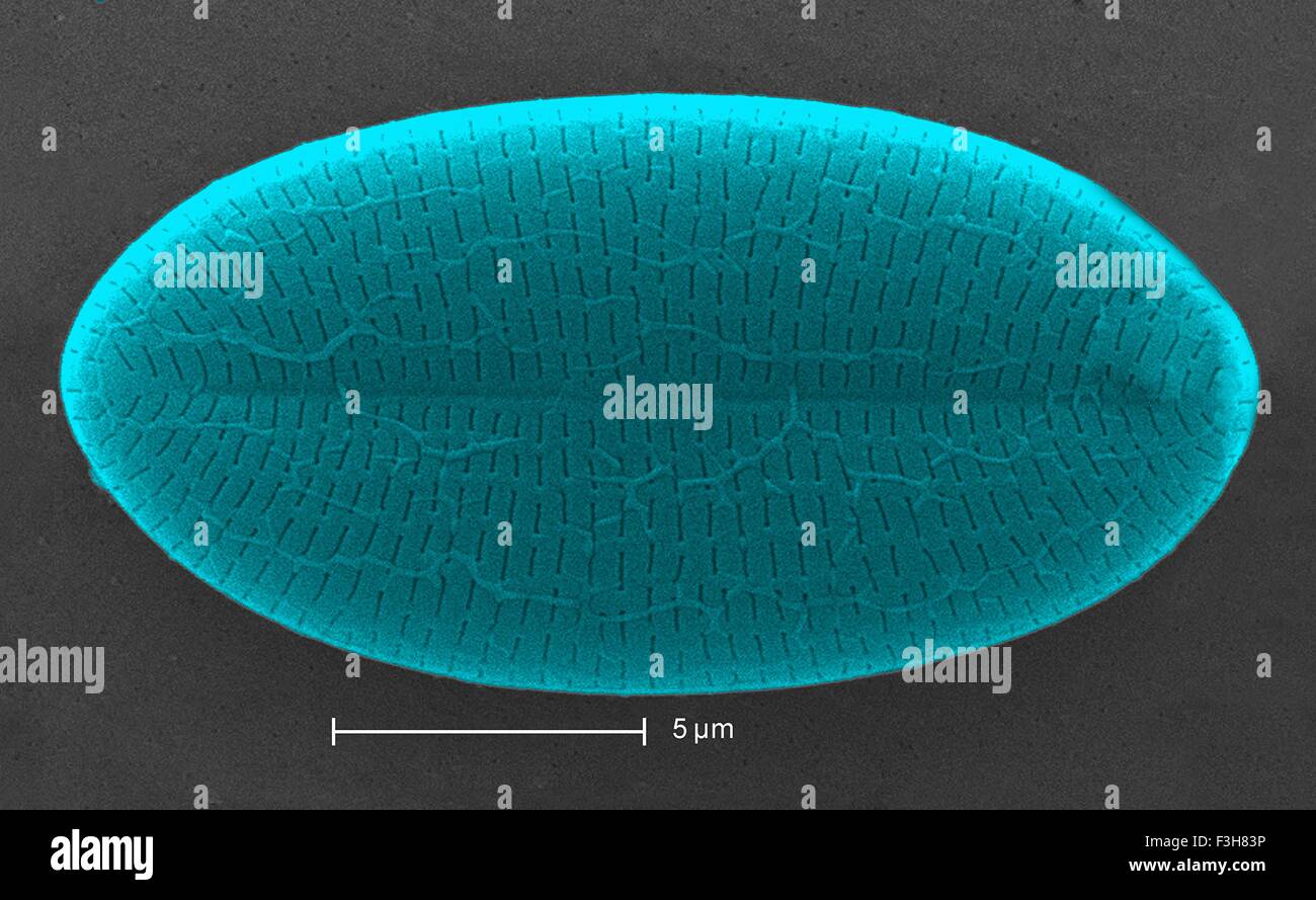 Scanning electron micrograph diatom Stock Photo