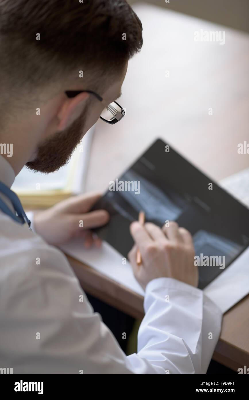 Doctor examining an elbow x-ray. Medicine and healthcare Stock Photo