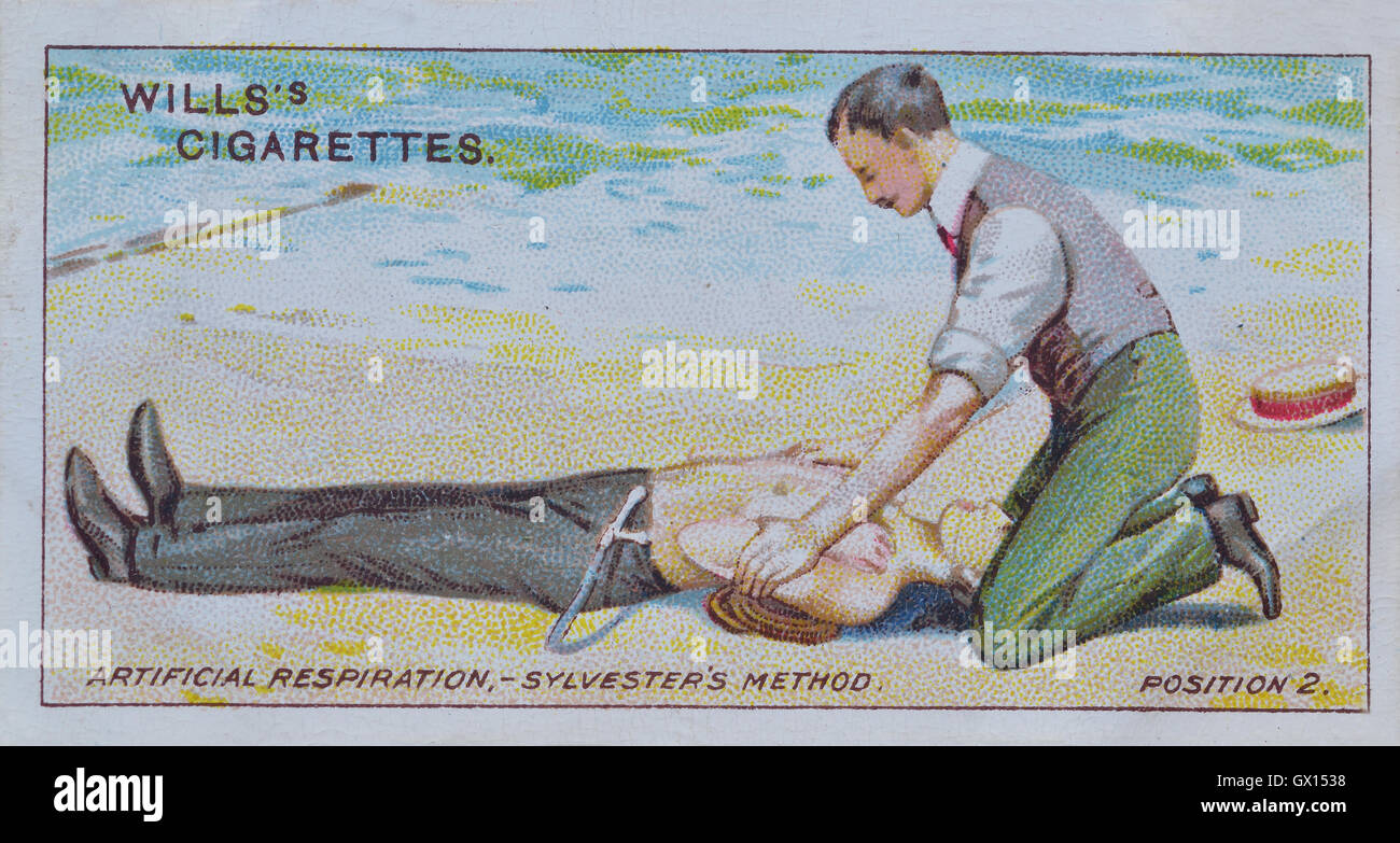 Will's cigarette card of artificial respiration. The Sylvester's method Stock Photo