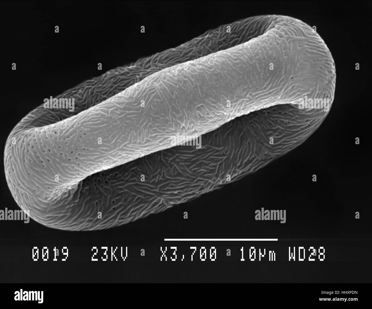 Cow parsley (Anthriscus sylvestris) pollen particle magnified under scanning electron microscope (SEM) Stock Photo