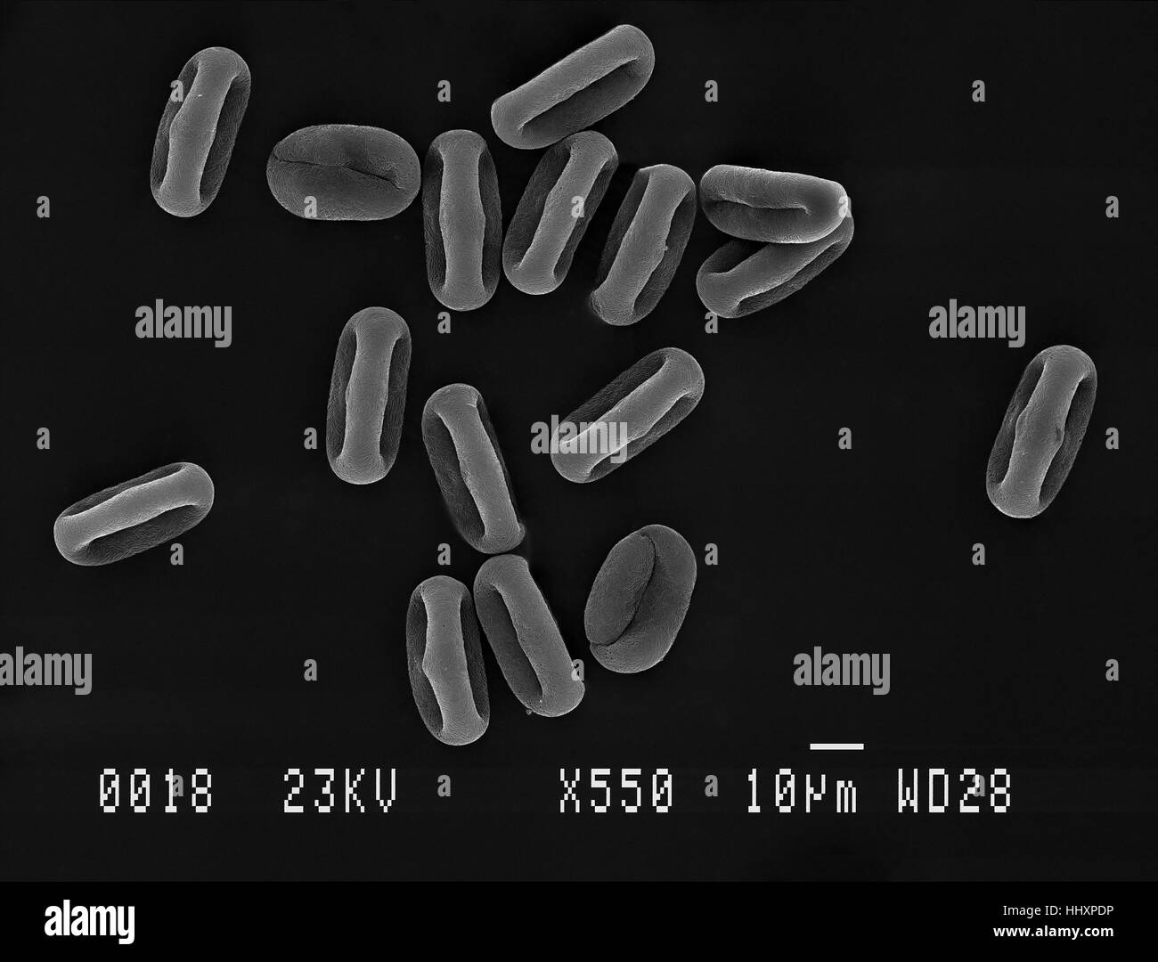 Many cow parsley (Anthriscus sylvestris) pollen grains magnified under scanning electron microscope (SEM), demonstrating shape at different angles. Stock Photo