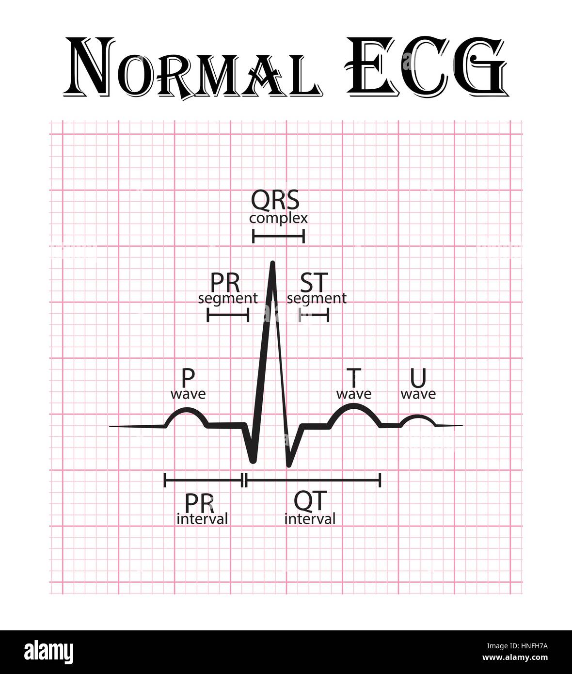 Normales EKG