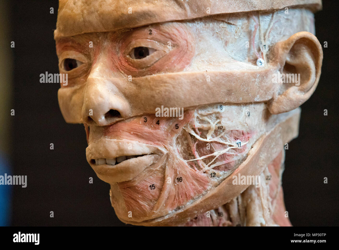 Anatomy of a real human head Stock Photo