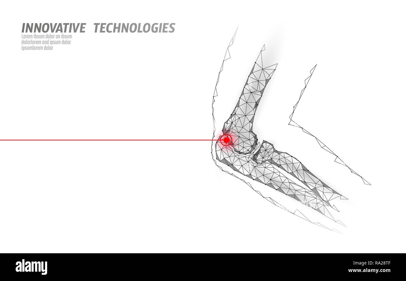 Human elbow joint 3d model vector illustration. Low poly design future technology cure pain treatment. White background and red injury man body arm medicine template Stock Vector