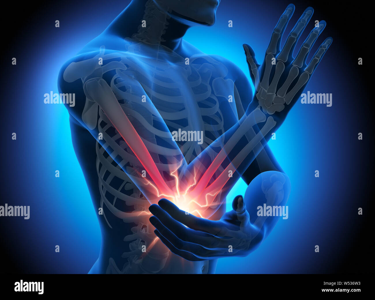 Man with strong pain in ellbow joint - 3D illustration Stock Photo