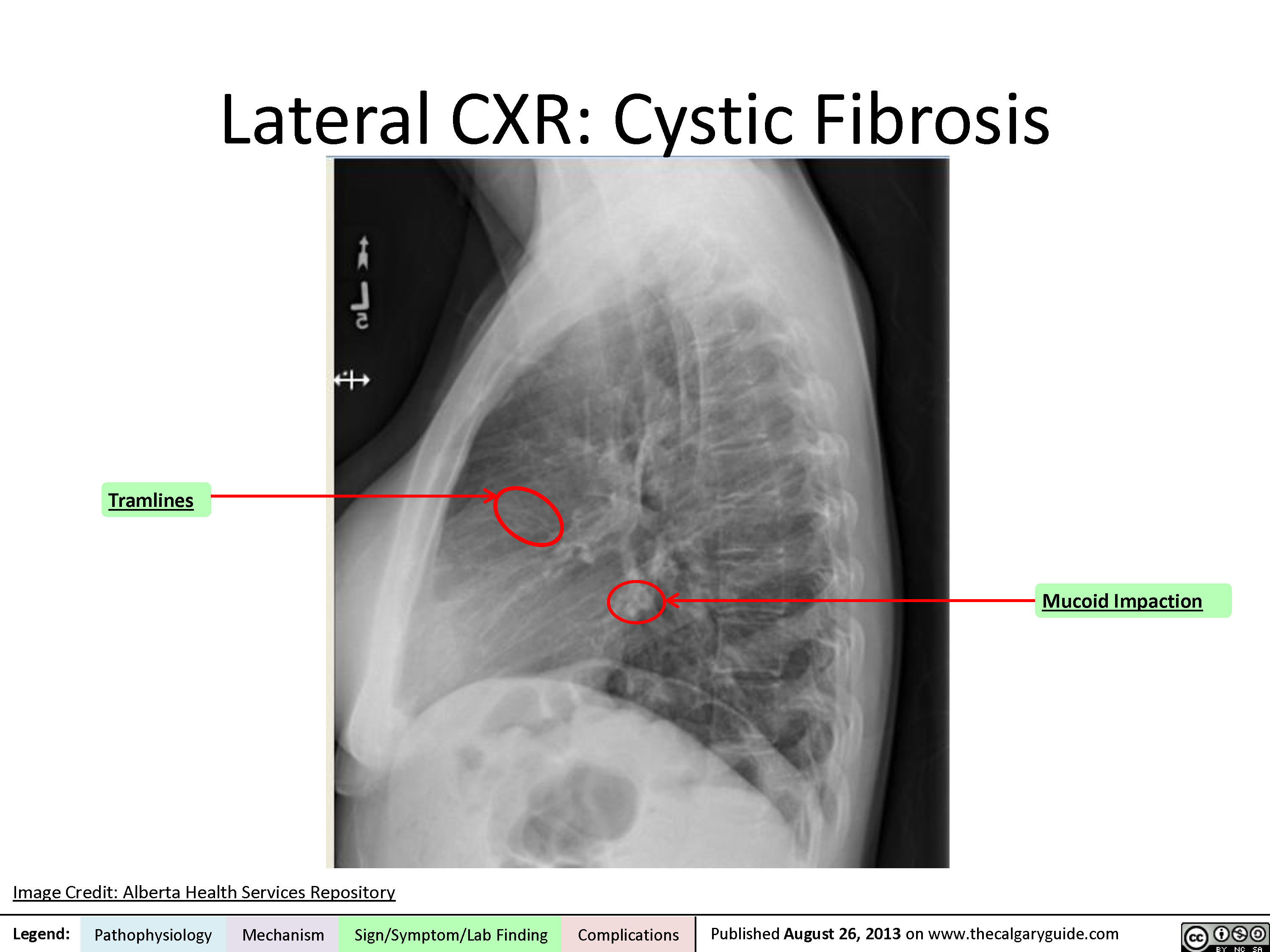 Lateral Chest X Ray Labeled image.