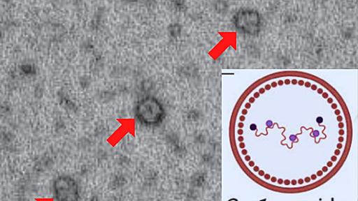 線虫は「粒子」で記憶を他の個体に転送していたと明らかに - ナゾロジー