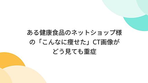 ある健康食品のネットショップ様の「こんなに痩せた」CT画像がどう見ても重症