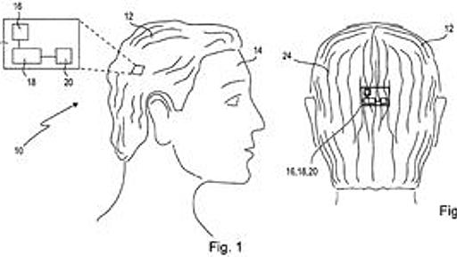 ソニーが「スマートヅラ」を特許出願。隠しカメラやバイブ、ズレセンサをカツラに内蔵 : 痛いニュース(ﾉ∀`)