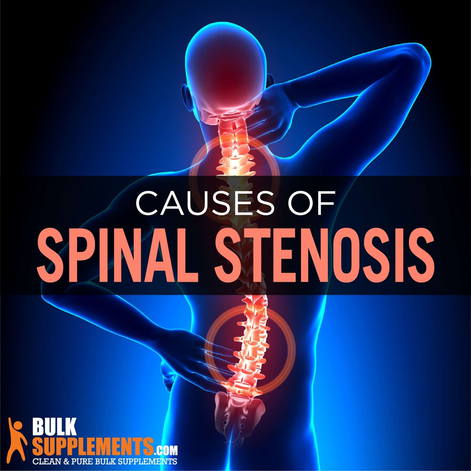 Spinal Stenosis Causes, Symptoms & Treatment by James Denlinger