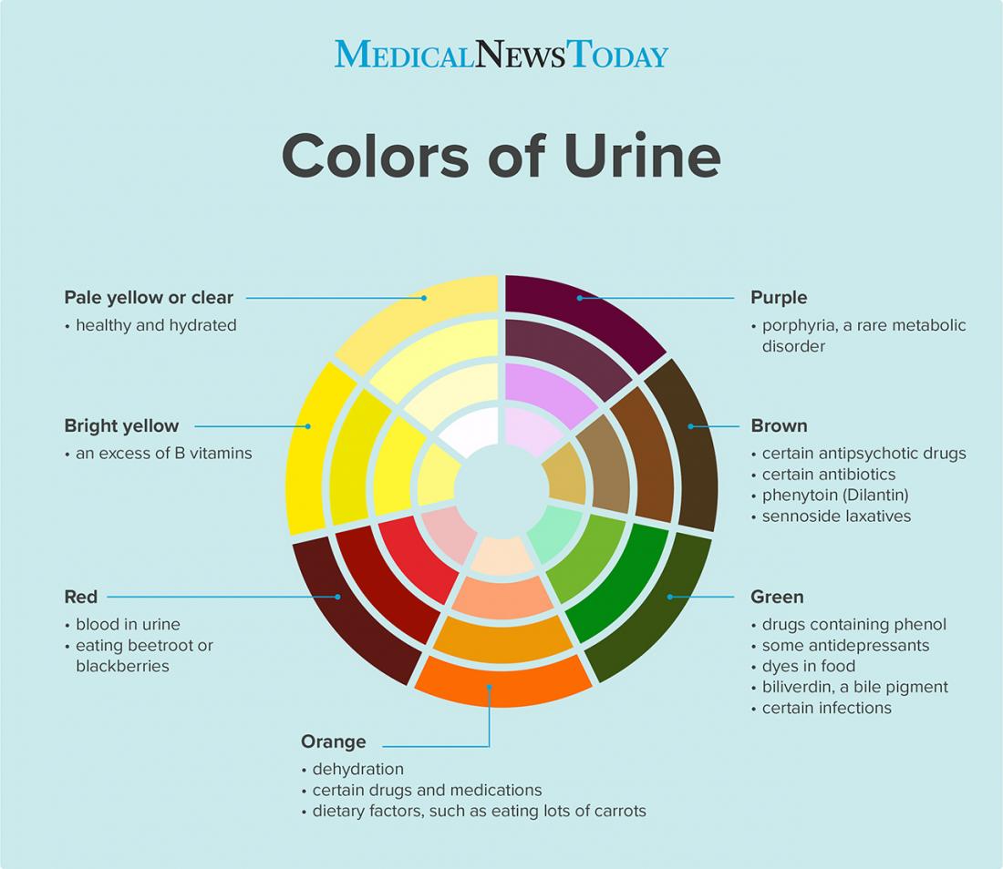 5 causes of dark urine