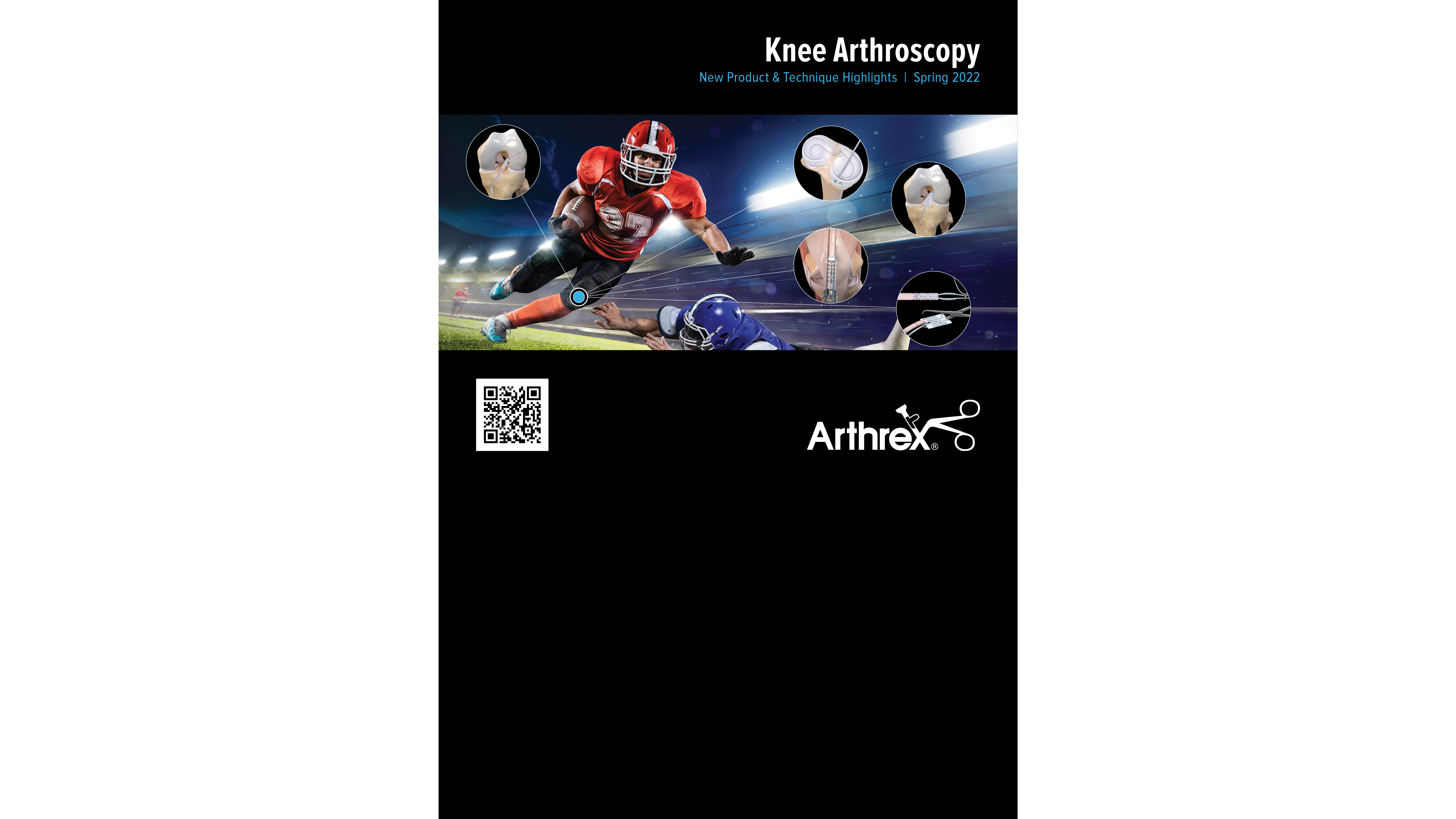 Knee Arthroscopy New Product & Technique Highlights