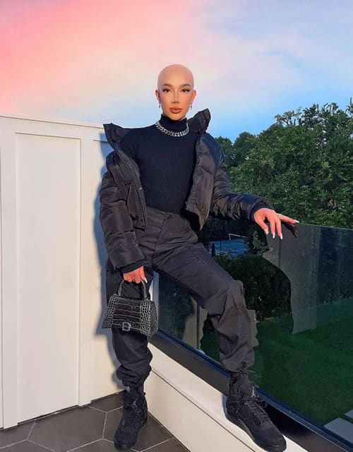 James Charles bald head instagram photo