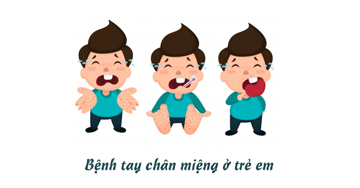 Tìm hiểu về bệnh tay chân miệng khám ở đâu ở bệnh viện nào uy tín nhất