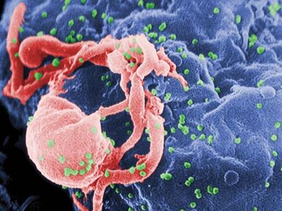 HIV/AIDS; retrovirus