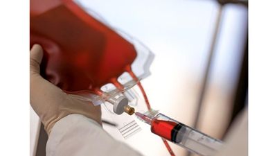 blood. Close-up of a technician drawing human blood with syringe from blood bag at a blood bank. Blood donation, Healthcare and medicine, needle