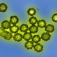 H1N1 influenza virus particles. Colorized transmission electron micrograph. Surface proteins on surface of the virus particles shown in black. Influenza flu