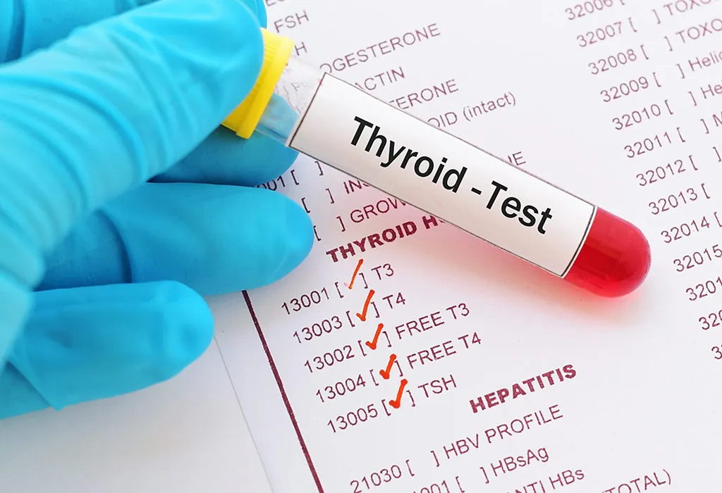 Diagnosis of Hypothyroidism