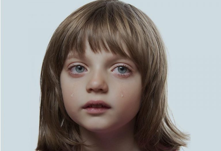 Watery Eyes (Epiphora) in Kids - Causes, Symptoms and Treatment