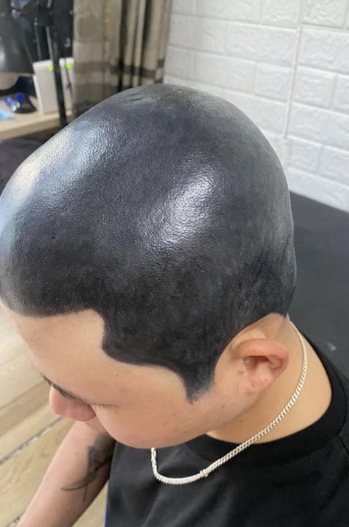 Brandwood Clinic on Twitter The fundamental point is this a good tattoo  looks like a tattoo a great tattoo looks like real body art Good Scalp  Micropigmentation looks like SMP excellent SMP