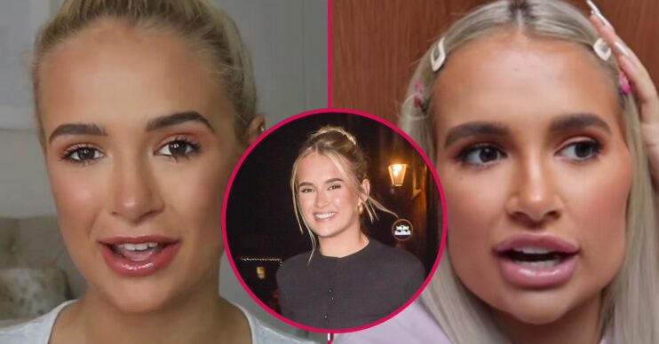 Split images of Molly-Mae showing her before and after cosmetic fillers