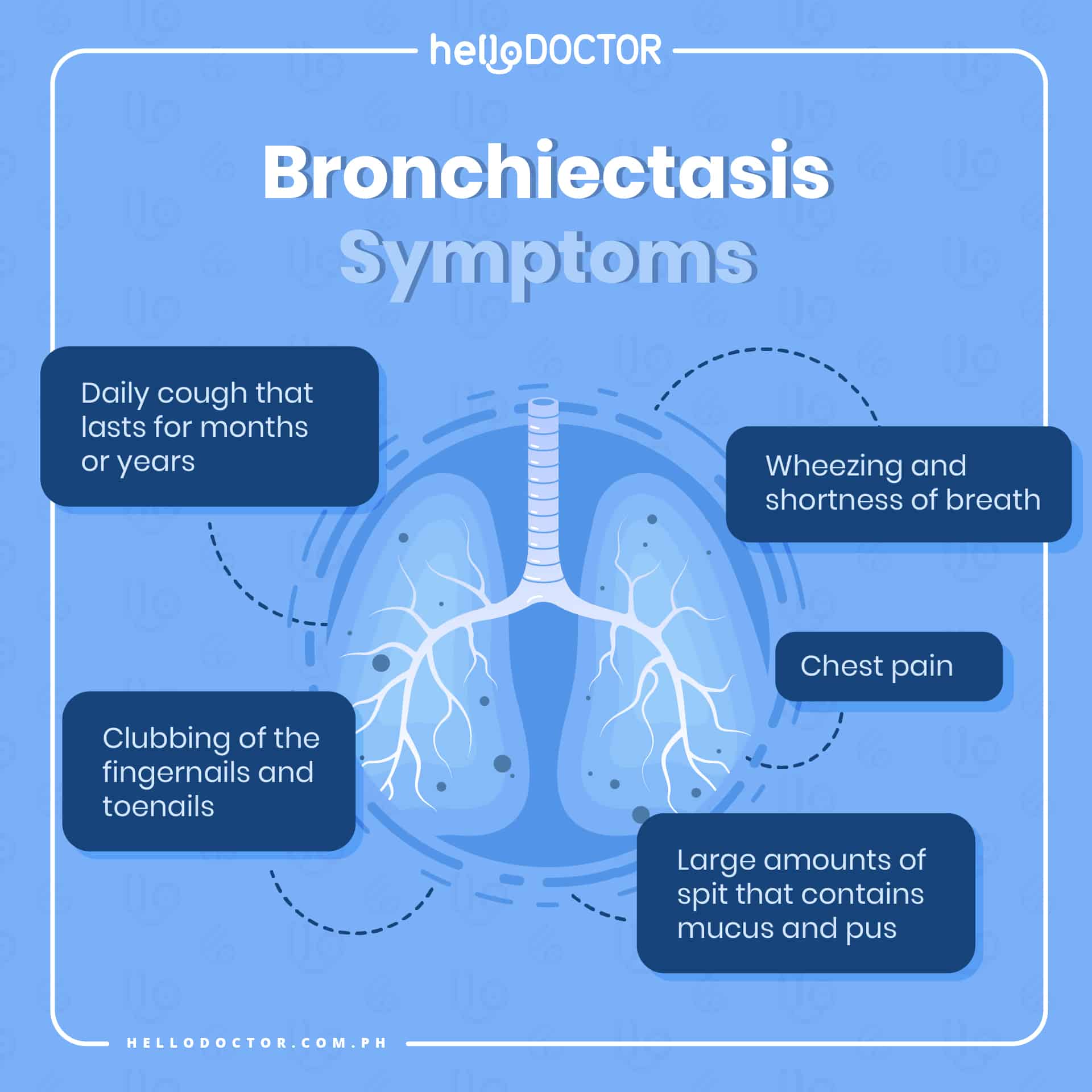 The Signs and Symptoms of Bronchiectasis You Need to Watch Out For