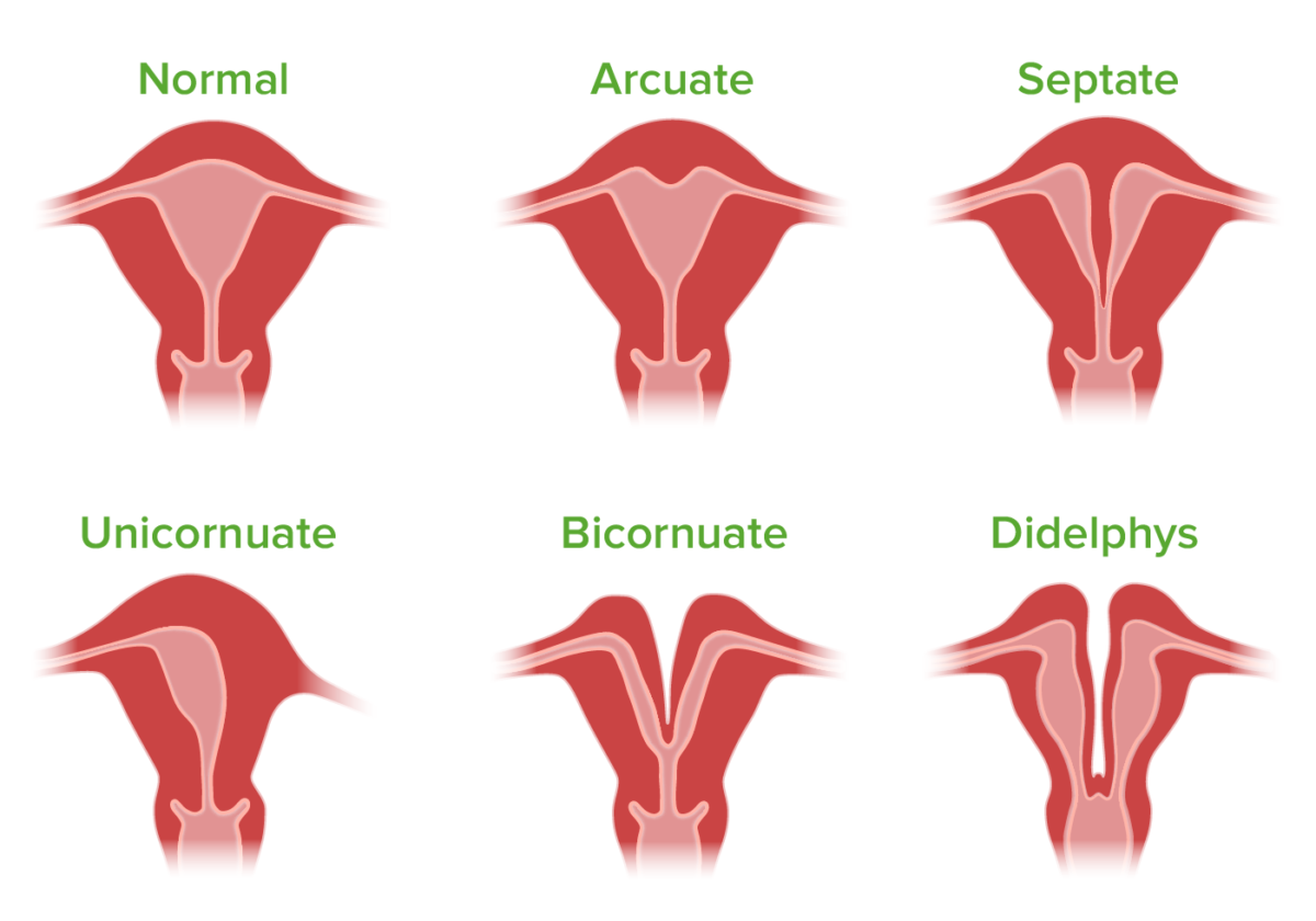 Female Reproductive System Diseases Uterus Womb Anatomy Thin Line ...