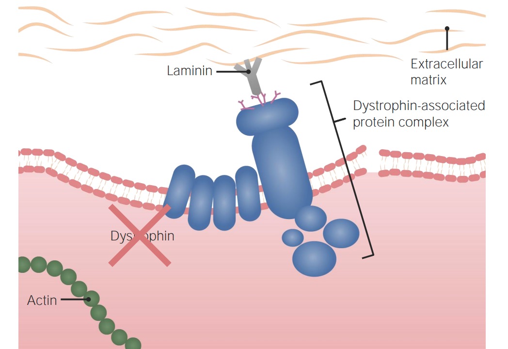 Duchenne Muscular Dystrophy Diagram