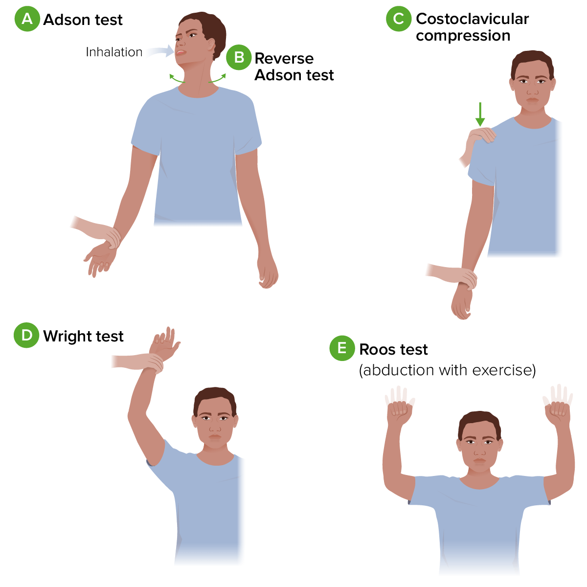 Thoracic outlet syndrome provocative tests