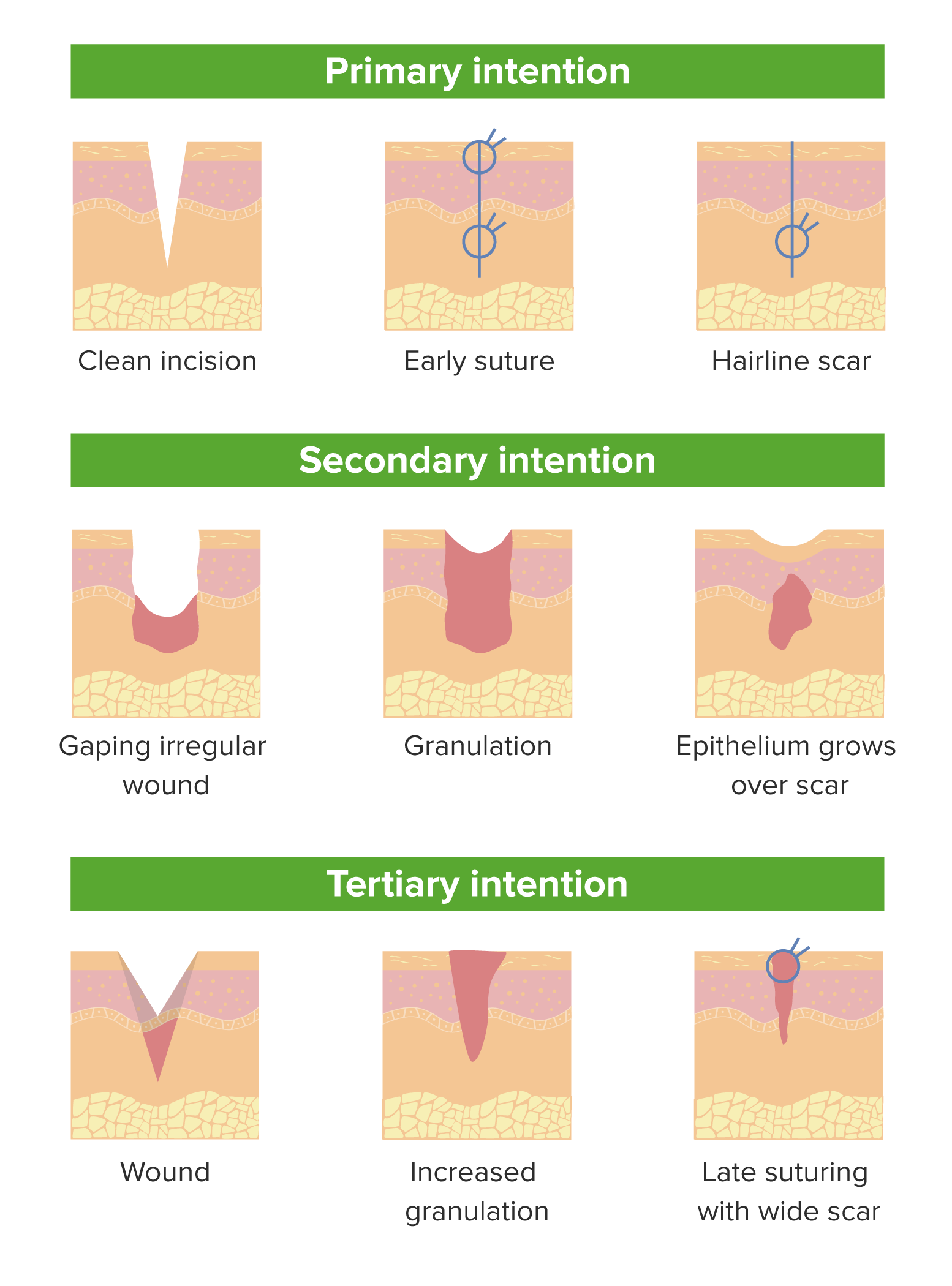 Wound Healing Before And After