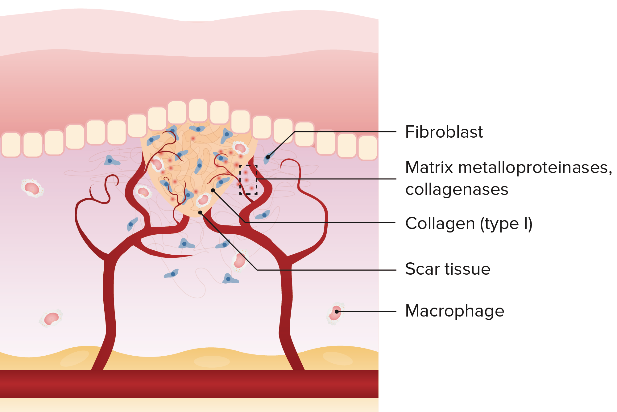 Stages Of Wound Healing Wound Healing Healing Wound Healing Nursing ...