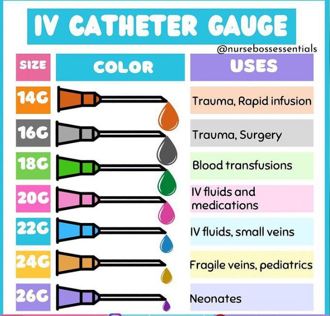 IV Catheter Sizes And Flow Rates Good For Med, 48% OFF