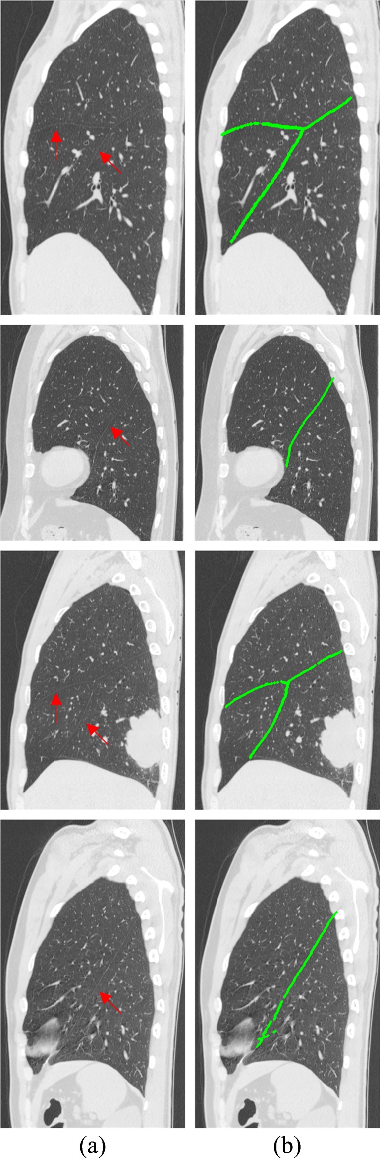 Fig. 5