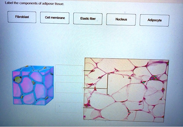 Label the components of adipose tissue.

Fibroblast	Cell membrane	Elastic fiber	Nucleus	Adipocyte