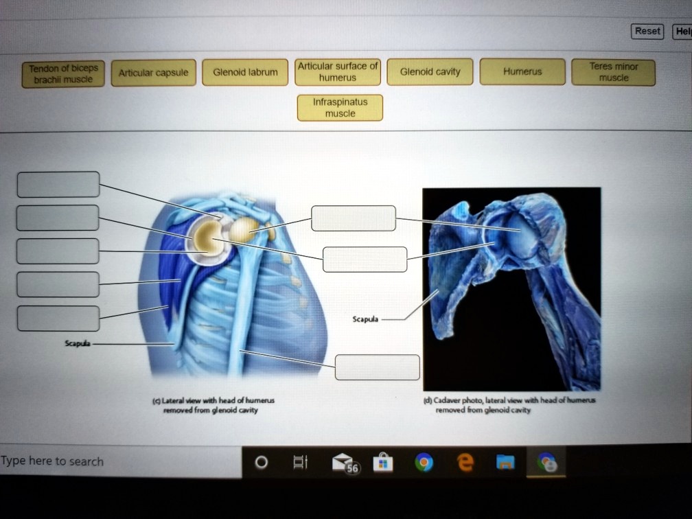 SOLVED: Hel Tendon of biceps brachii muscle Glenoid labrum Articular ...