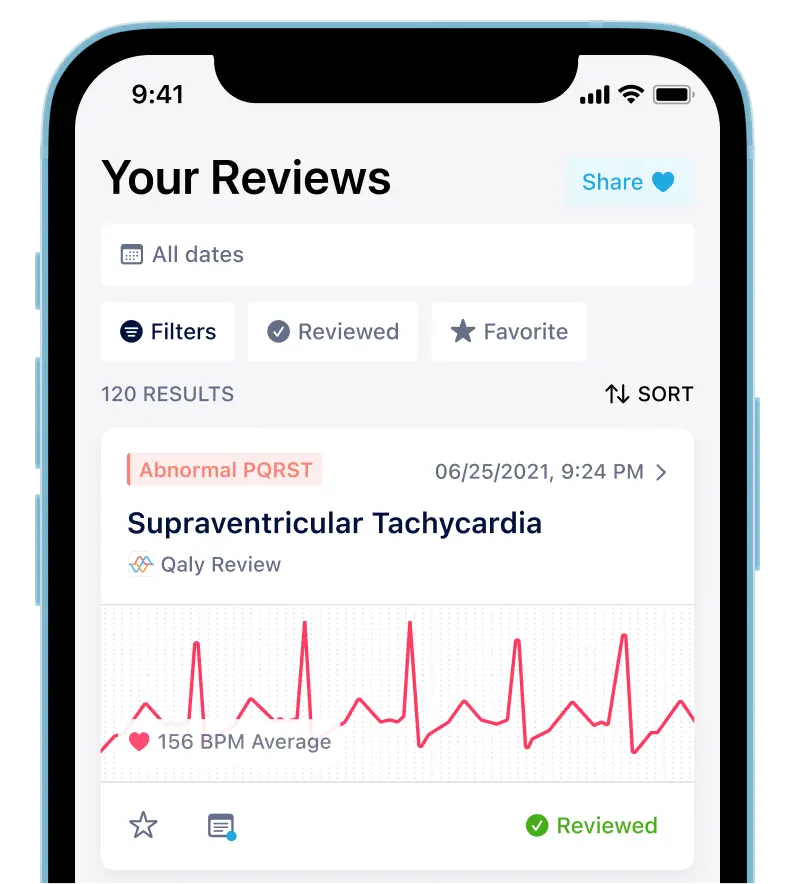 QALY app - ecg reviews, ecg reader, ecg interpretations, review your ecg