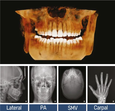 Tomógrafo dental cone beam