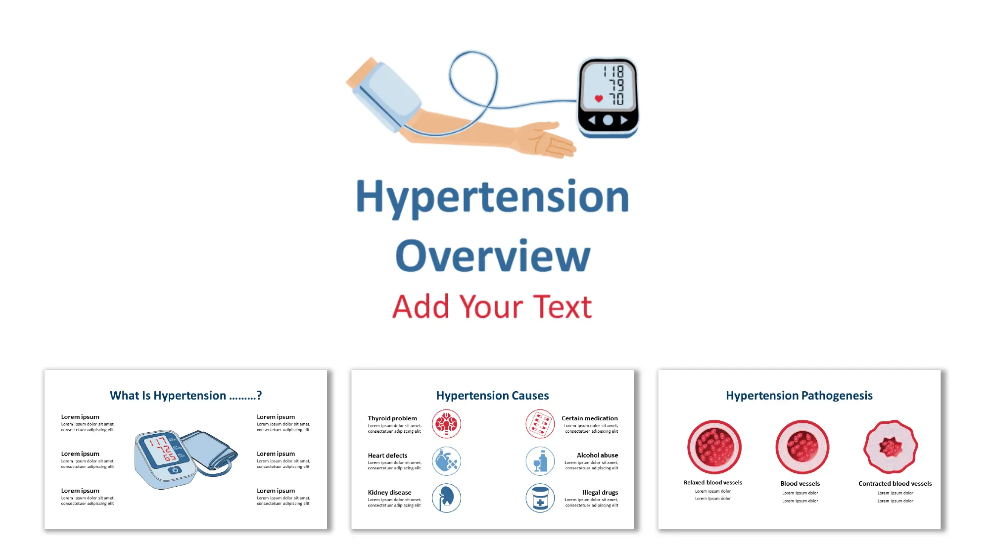 hypertension overview of ppt