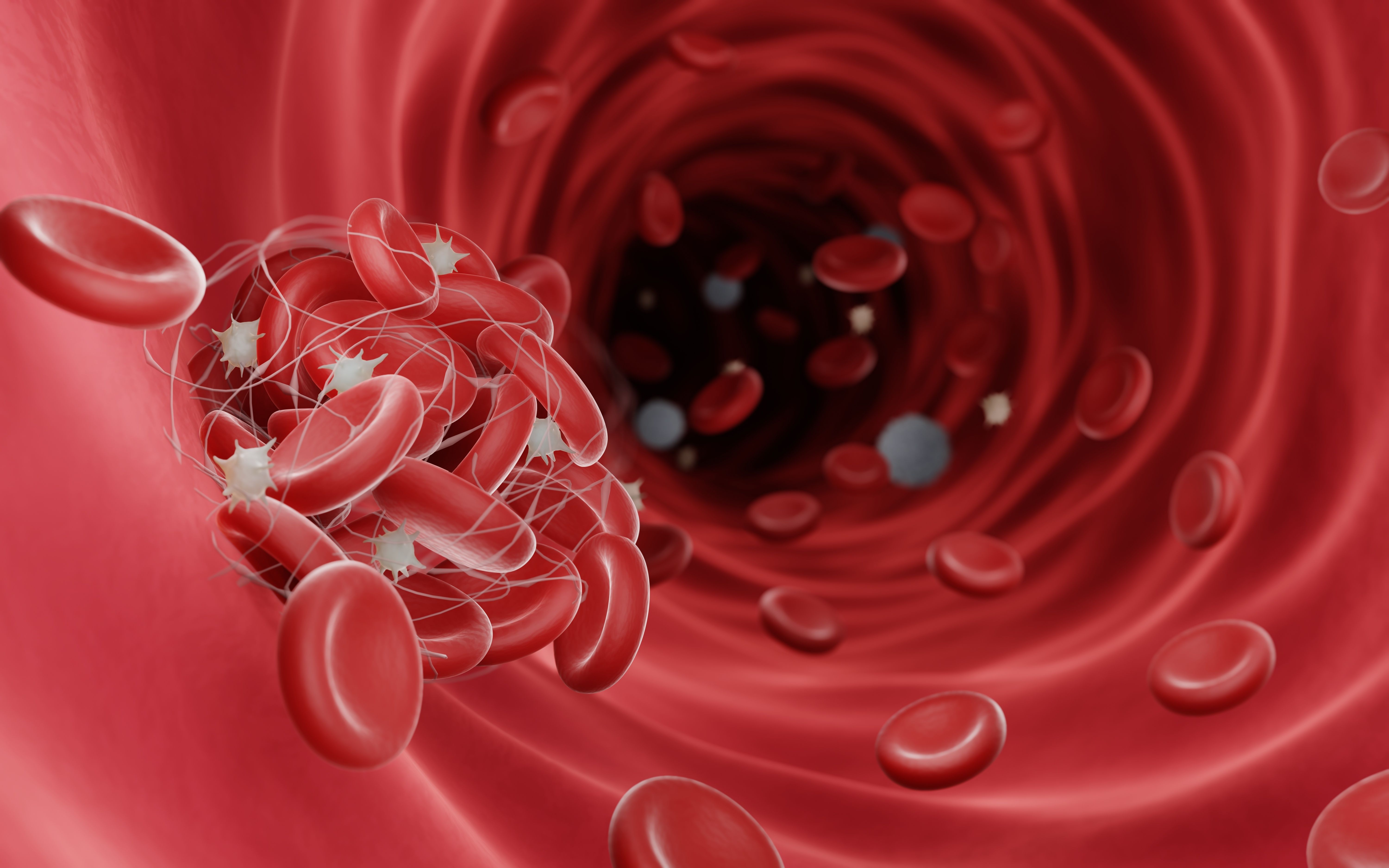 Clotting complications are a severe symptom of TTP | image credit: Artur - stock.adobe.com