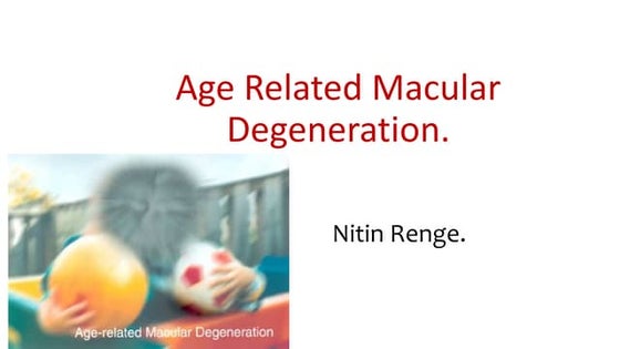 Age related macular degeneration nitin