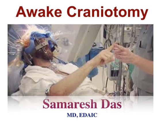 Awake craniotomy 