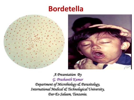 Bordetella