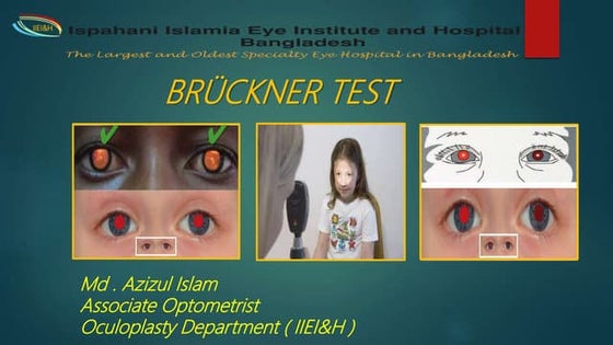 Bruckner test