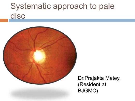 approaches to pale disc