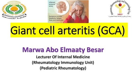 Gaint cell arteritiis (GCA)