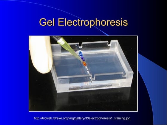 Gel electrophoresis 08