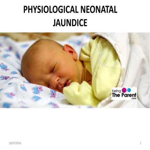 Physiological Neonatal Jaundice | PPT