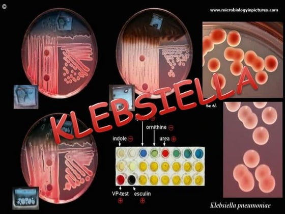 KLEBSIELLA SLIDESHARE PRESENTATION