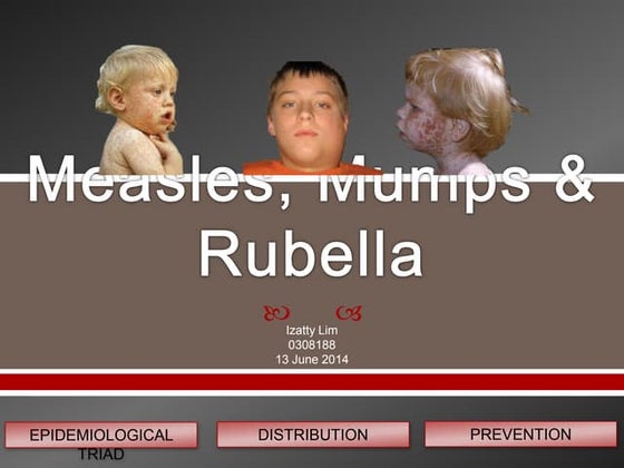 Measles, mumps & rubella